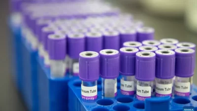 Kahramanmaraş’ın Elbistan ilçesinde 67 yaşındaki Gülseren Alkaya’ya yanlış kan verilmesi