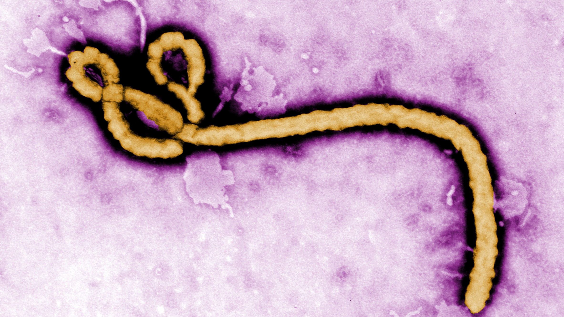 DSÖ'den Ebola Uyarısı: Aşı Çalışmaları 9 Ay Kadar Sürebilir