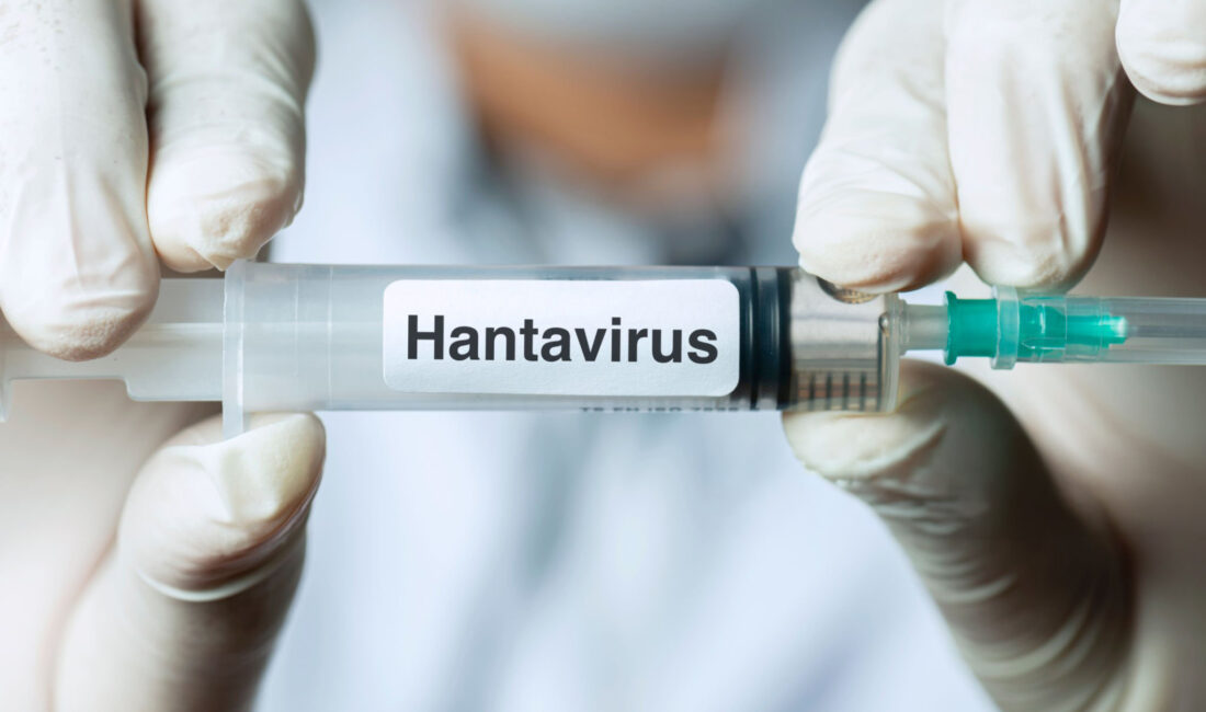 uzmanlar, hantavirüs enfeksiyonunun yüksek ateş ve halsizlik gibi belirtilerle gribe