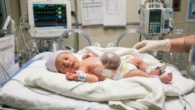 Omfalosel, yenidoğanlarda görülen nadir fakat ciddi bir karın duvarı gelişim