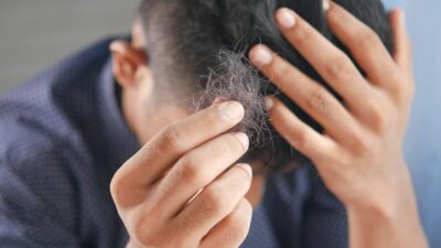 Firmanın açıklamasına göre, ABD'li biyoteknoloji şirketi Veradermics tarafından geliştirilen uzatılmış