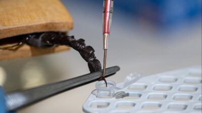 Sağlık Bakanlığı Halk Sağlığı Genel Müdürlüğü bünyesindeki laboratuvarda, akrep sokmalarına