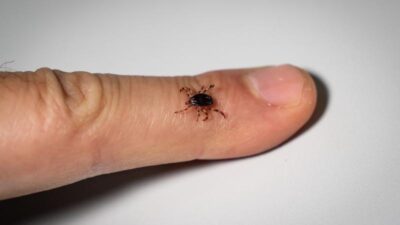 Erzincan'da bu sezon Kırım Kongo Kanamalı Ateşi (KKKA) şüphesiyle hastaneye