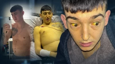 İngiltere'de yaşayan 25 yaşındaki Kieran Cooper, bebekliğinden bu yana mücadele