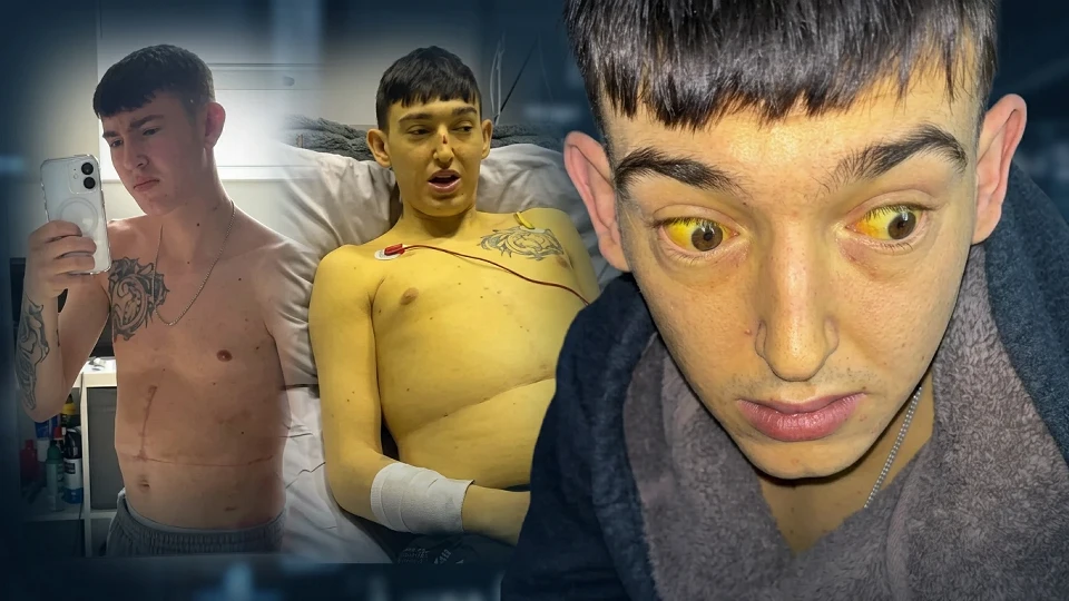 İngiltere'de yaşayan 25 yaşındaki Kieran Cooper, bebekliğinden bu yana mücadele